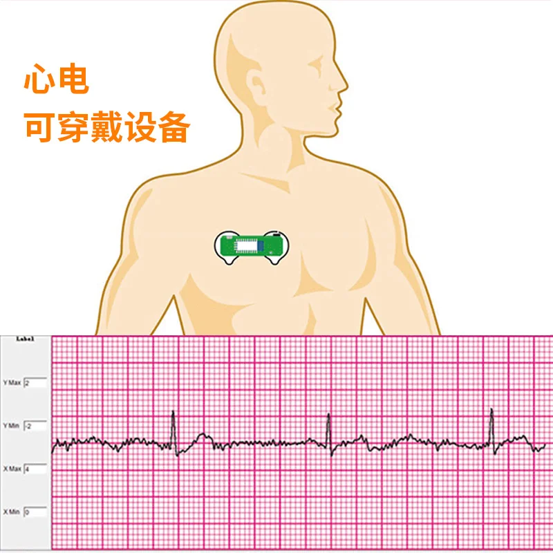 BMD101 ECG Electrocardiogram S – Ecg Patch Monitor Bewertung und Preis